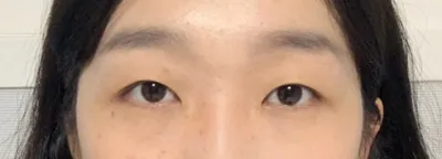 Давхрааны хагалгааны сэтгэгдлээ оруулж байна!!