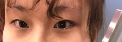 Давхрааны хагалгааны шилдэг эмнэлгээ оллоо!!