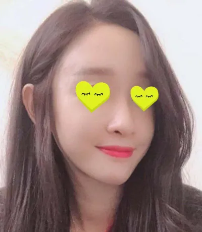 Ким Жүн Хён эмчээр нүүрний өөх шилжүүлэн суулгах хагалгаа хийлгэсэн!