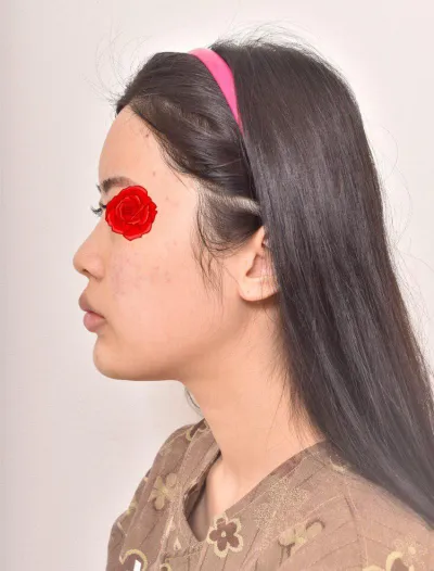 Сэтгэл хангалуун байна!! Им Ён Мин эмчдээ баярлалаа