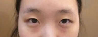 Very Good гоо сайхны эмнэлгийн Ким Жүн Хён эмчээр хийлгэсэн