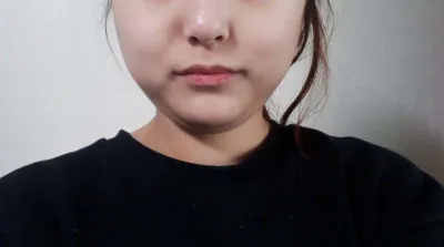 Амьдралдаа анх удаа өөх соруулах хагалгаа хийлгэж үзлээ~!