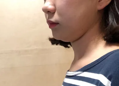 Давхар эрүүний өөх соруулах хагалгаа бол шинэ ертөнц л гэсэн үг..bb