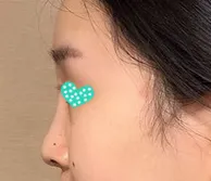 Хамрын хагалгаа хийлгээд 63 хоног өнгөрчээ~