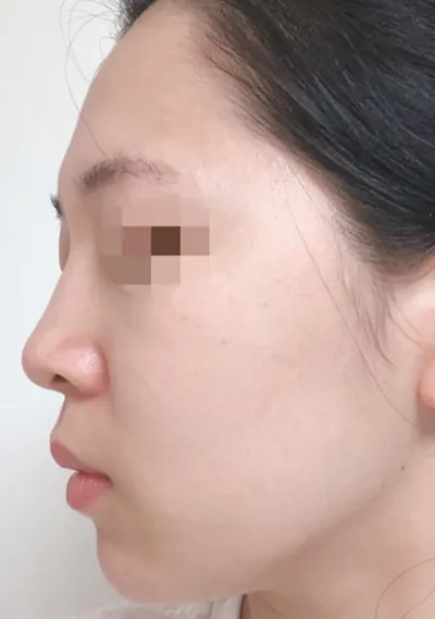 Өөх | Бусад хагалгааны сэтгэгдэл