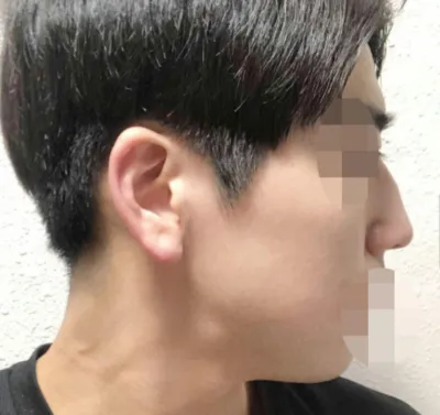 Хамарны хагалгааны сэтгэгдэл