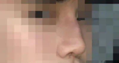 Хамарны хагалгааны сэтгэгдэл