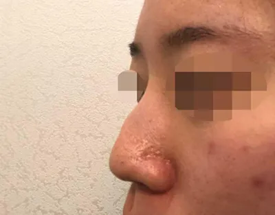 Хамарны хагалгааны сэтгэгдэл