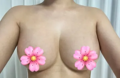 Мелон Ким Жү Вон эмч, Мотива эцэст нь 1 сар боллоо! Сэтгэгдэл