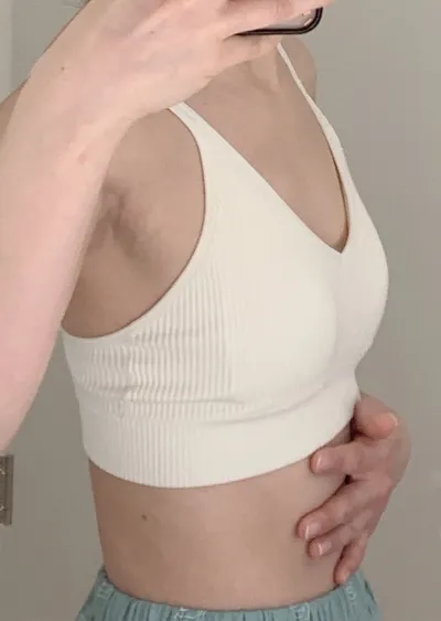 Хөхний гоо сайхны хагалгаа 2 сарын дараах сэтгэгдэл (Мотива/ 355cc/ Хөхний доогуур)