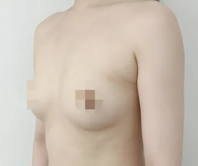 Себин Саб 6 сар) ☆75B-ээс 65E☆ Тэгш бус байдлыг засах хүртэл☆