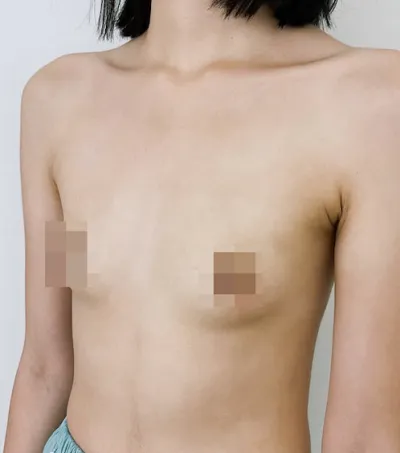 Motiva 1 дэх сар) Ганц ч гэсэн насаар залуу байхдаа хийлгэхийг зөвлөж байна! (Урт бичвэр)