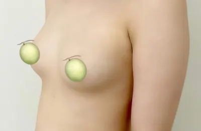 2 долоо хоног болоход 1 дэх долоо хоногоос хамаагүй дээрдэж, бие хөнгөрлөө~~