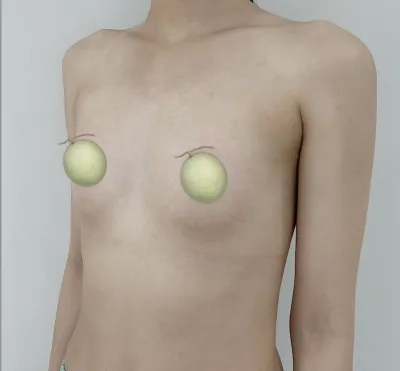 1 сар болж байна~ Хувцас өмсөхөд биеийн галбир өөрчлөгдсөнд маш их баяртай байна!!