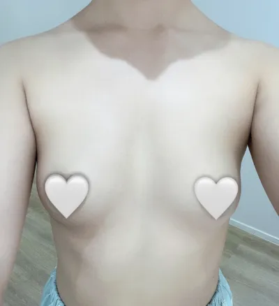 Mentor Xtra + Суганы илүүдэл мах авах) 1 сарын дараах маш их сэтгэл хангалуун сэтгэгдэл