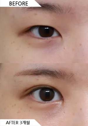 Before