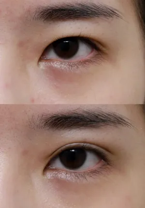 After
