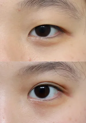 After