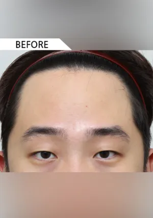 Before