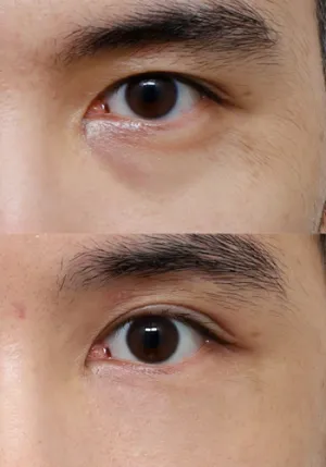After