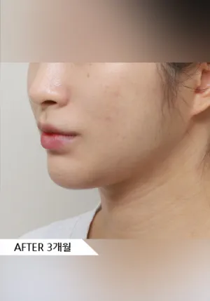 After