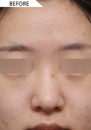 Before