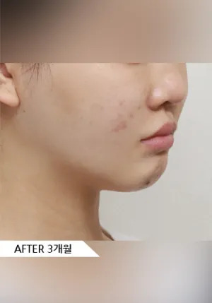 After