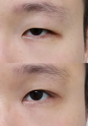 After