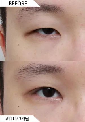 Before