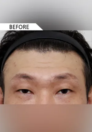 Before
