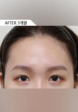 After