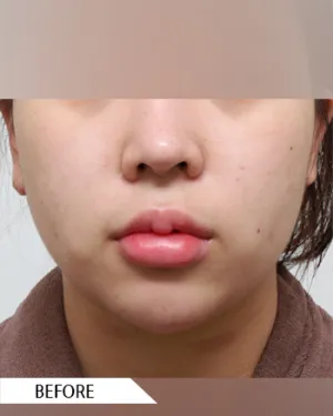 Before