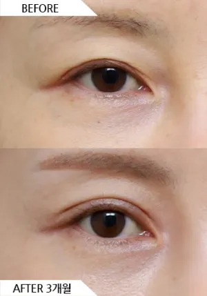 Before