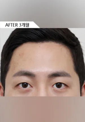 After