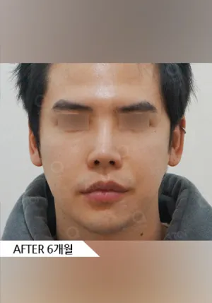 After