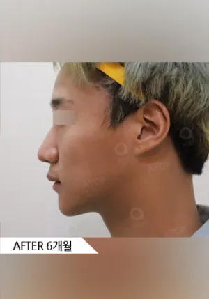 After