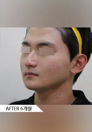 After