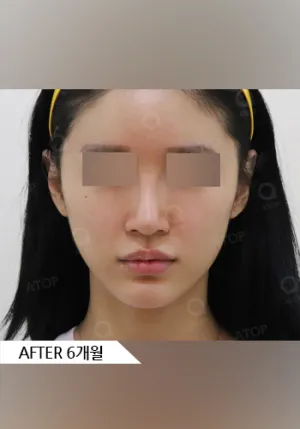 After
