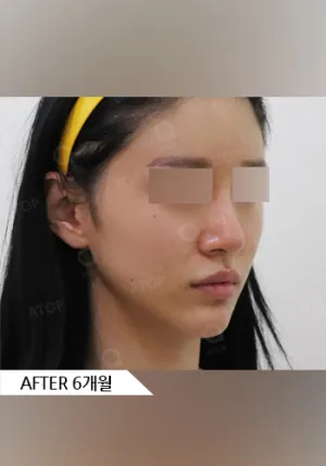 After