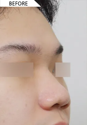 Before