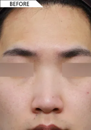 Before