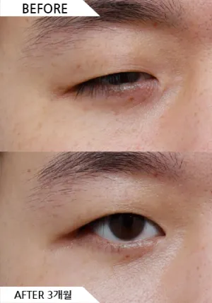 Before