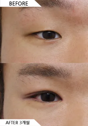 Before