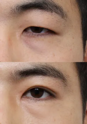 After