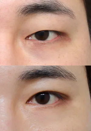 After