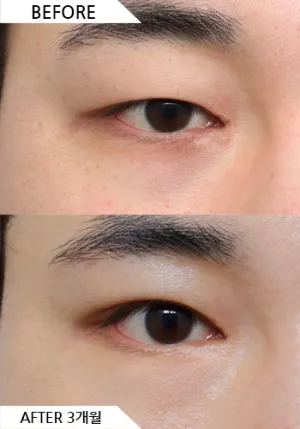 Before