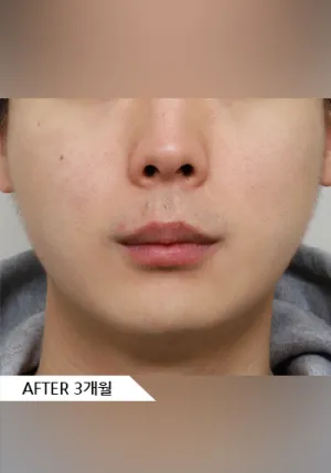 After