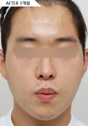 After