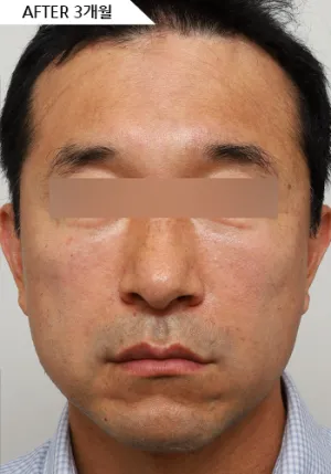 After