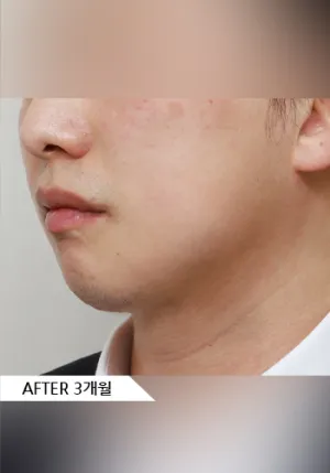 After